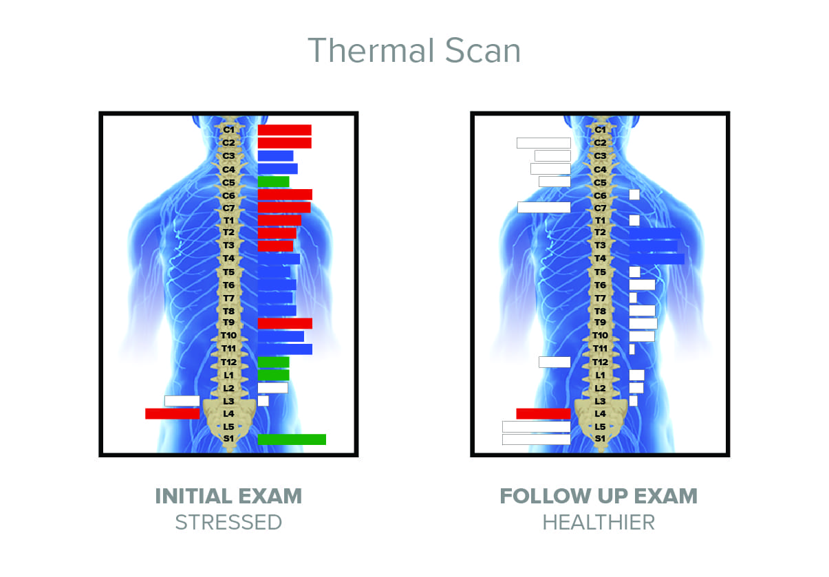 Thermal-Scan_definitely-use_